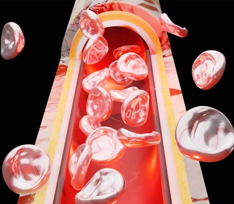 Hyperaktiva immunförsvar